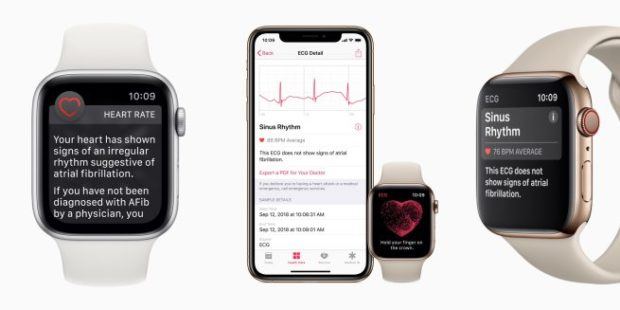 Da questa sera disponibile watchOS 5.1.2 che integra l'ECG su Apple Watch Serie 4 1