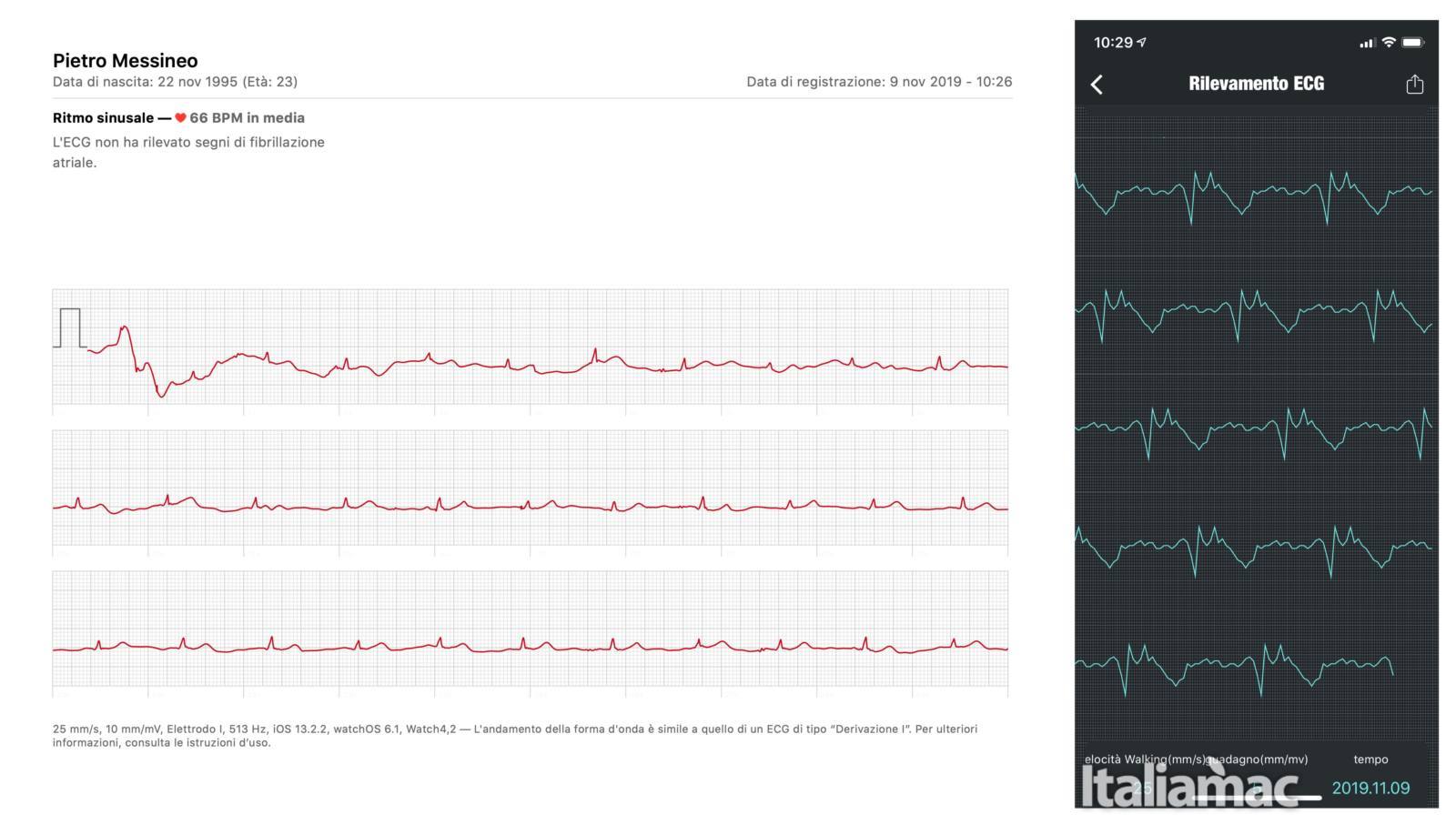 NO.1 DT68: Lo smartwatch impermeabile con ECG e Gorilla Glass 9